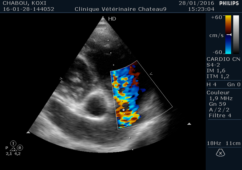 doppler pulmonaire