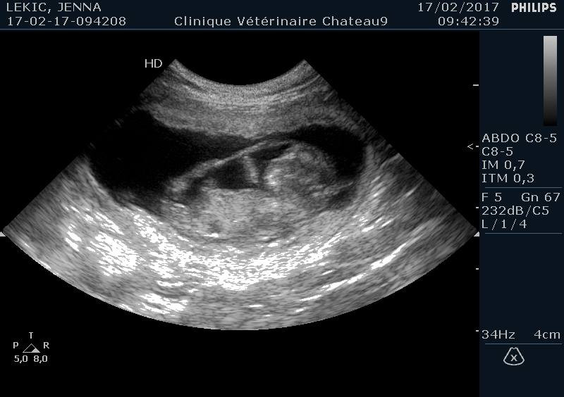 echographie diagnostic de gestation